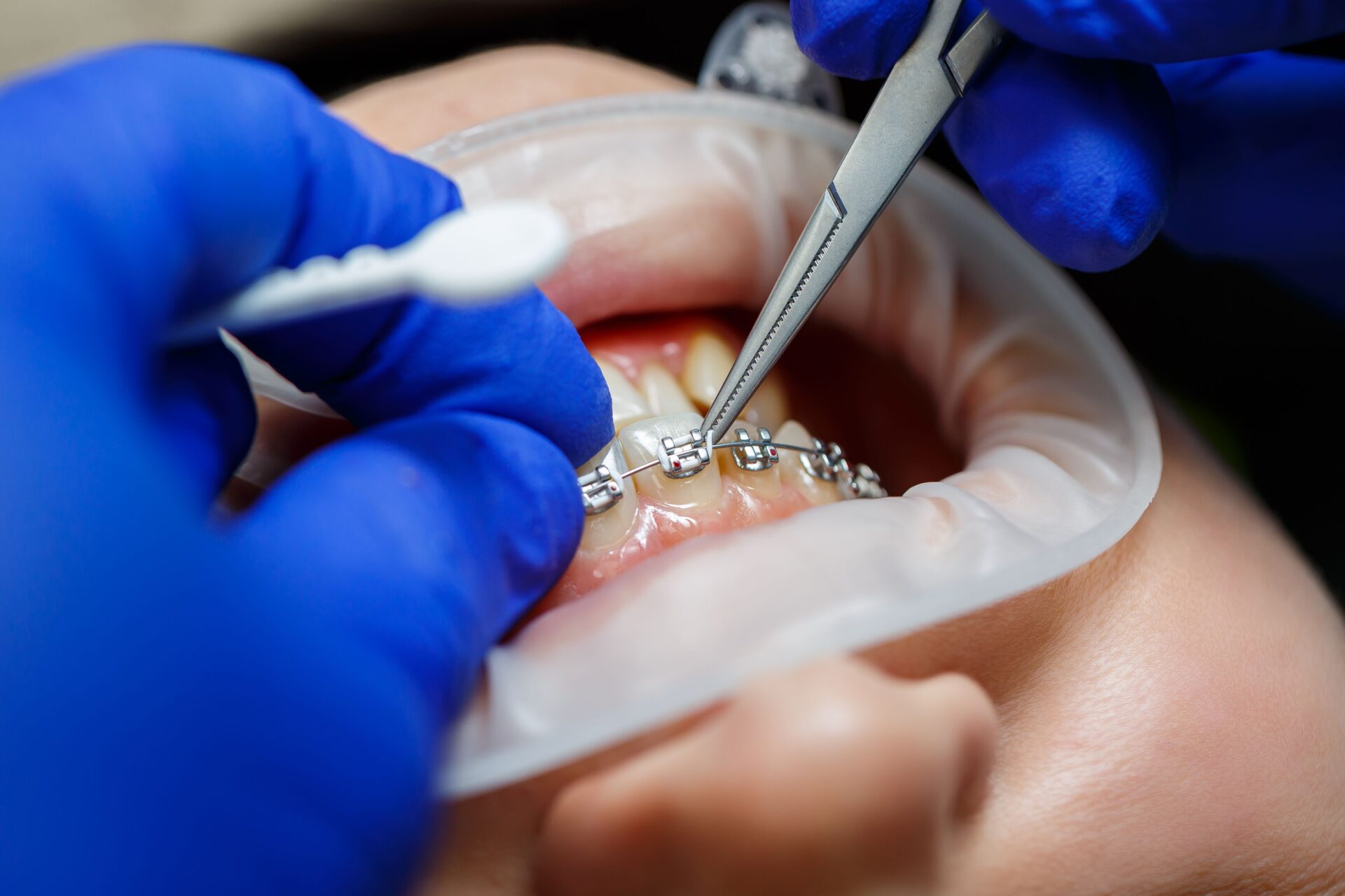 Orthodontic Treatment Dental Clinic